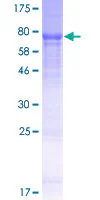 SDS-PAGE - Recombinant Human GSDMC protein (GST tag N-Terminus) (AB163356)