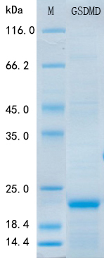 SDS-PAGE - Recombinant Human GSDMD Protein Standard (His tag) (AB316418), expandable thumbnail