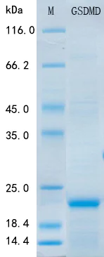 SDS-PAGE - Recombinant Human GSDMD Protein Standard (His tag) (AB316418)