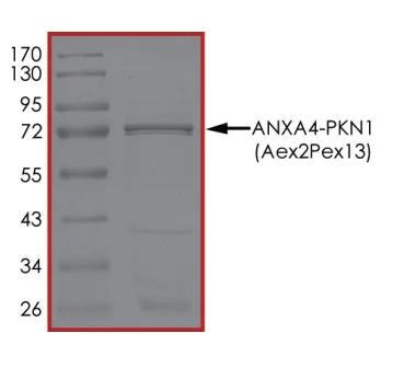 SDS-PAGE - Recombinant human GST-Annexin-4/ANXA4-PKN fusion protein (Active) (AB268348)