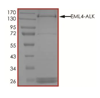 SDS-PAGE - Recombinant human GST-EML4-ALK protein (Active) (AB268523)