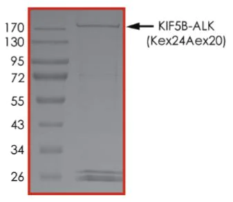 SDS-PAGE - Recombinant human GST-KIF5B-ALK fusion protein (Active) (AB268705)