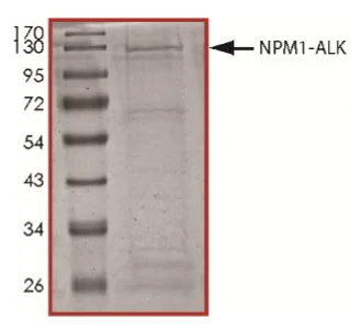 SDS-PAGE - Recombinant human GST-Nucleophosmin-ALK fusion protein (Active) (AB268820)