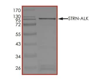 SDS-PAGE - Recombinant human GST-Striatin-ALK fusion protein (Active) (AB268984)