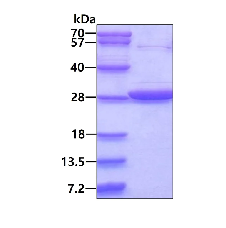 SDS-PAGE - Recombinant Human GSTT2 protein (His tag N-Terminus) (AB124591)