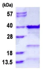 SDS-PAGE - Recombinant Human GTF2E2 protein (His tag N-Terminus) (AB126665)