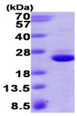 SDS-PAGE - Recombinant Human GTPase HRAS protein (AB93949)
