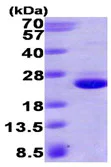 SDS-PAGE - Recombinant Human GTPase HRAS protein (His tag C-Terminus) (AB93949)
