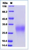 SDS-PAGE - Recombinant Human GYPC protein (His tag) (AB276669)