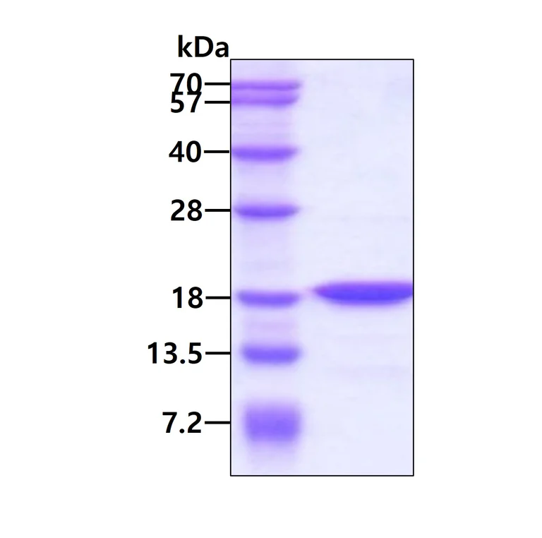 SDS-PAGE - Recombinant Human H-FABP protein (His tag N-Terminus) (AB84335)