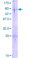 SDS-PAGE - Recombinant Human HADHB protein (GST tag N-Terminus) (AB158632)