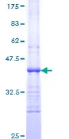 SDS-PAGE - Recombinant Human Hamartin protein (AB152772)