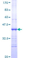 SDS-PAGE - Recombinant Human Hamartin protein (GST tag N-Terminus) (AB152772)
