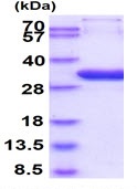 SDS-PAGE - Recombinant Human HAND1 protein (denatured) (His tag N-Terminus) (AB134618)