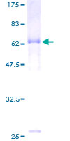 Recombinant Human HAPLN1 protein