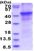 SDS-PAGE - Recombinant Human HAPLN1 protein (denatured) (His tag N-Terminus) (AB180280)
