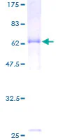 SDS-PAGE - Recombinant Human HAPLN1 protein (GST tag N-Terminus) (AB158200)