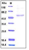 SDS-PAGE - Recombinant Human HAPLN1 protein (His tag) (AB276245)