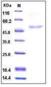 SDS-PAGE - Recombinant Human HAPLN1 protein (His tag) (AB276245)