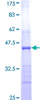 Recombinant Human HAPLN2 protein
