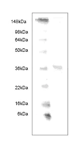 SDS-PAGE - Recombinant Human Haptoglobulin beta protein (AB63120)