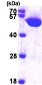 SDS-PAGE - Recombinant Human HARS protein (His tag N-Terminus) (AB99387)