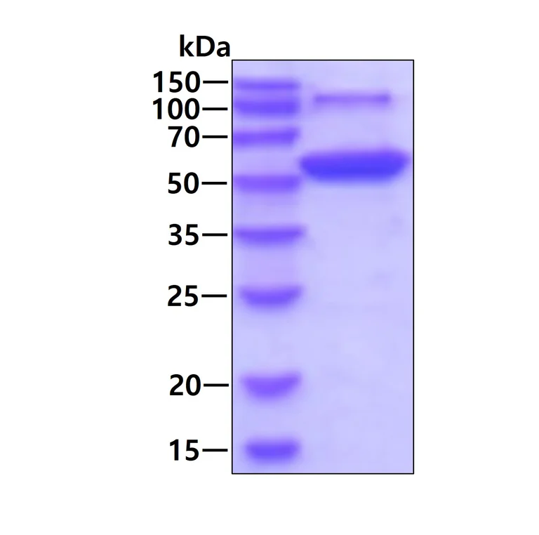 SDS-PAGE - Recombinant Human HARS protein (His tag N-Terminus) (AB99387)