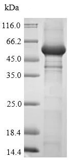 SDS-PAGE - Recombinant Human HAUSP / USP7 protein (Tagged) (AB239558)