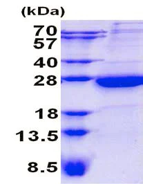 SDS-PAGE - Recombinant Human HBP protein (His tag N-Terminus) (AB139244)