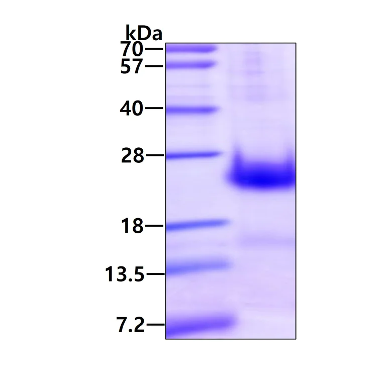 SDS-PAGE - Recombinant Human hCG beta protein (His tag) (AB223019)