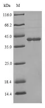 SDS-PAGE - Recombinant Human hCG receptor/LHR protein (His tag) (AB267899)