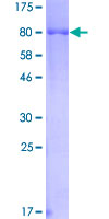 Recombinant Human Hck protein