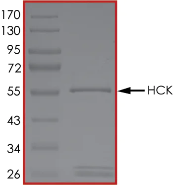 SDS-PAGE - Recombinant human Hck protein (AB60865)