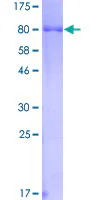 SDS-PAGE - Recombinant Human Hck protein (GST tag N-Terminus) (AB131827)