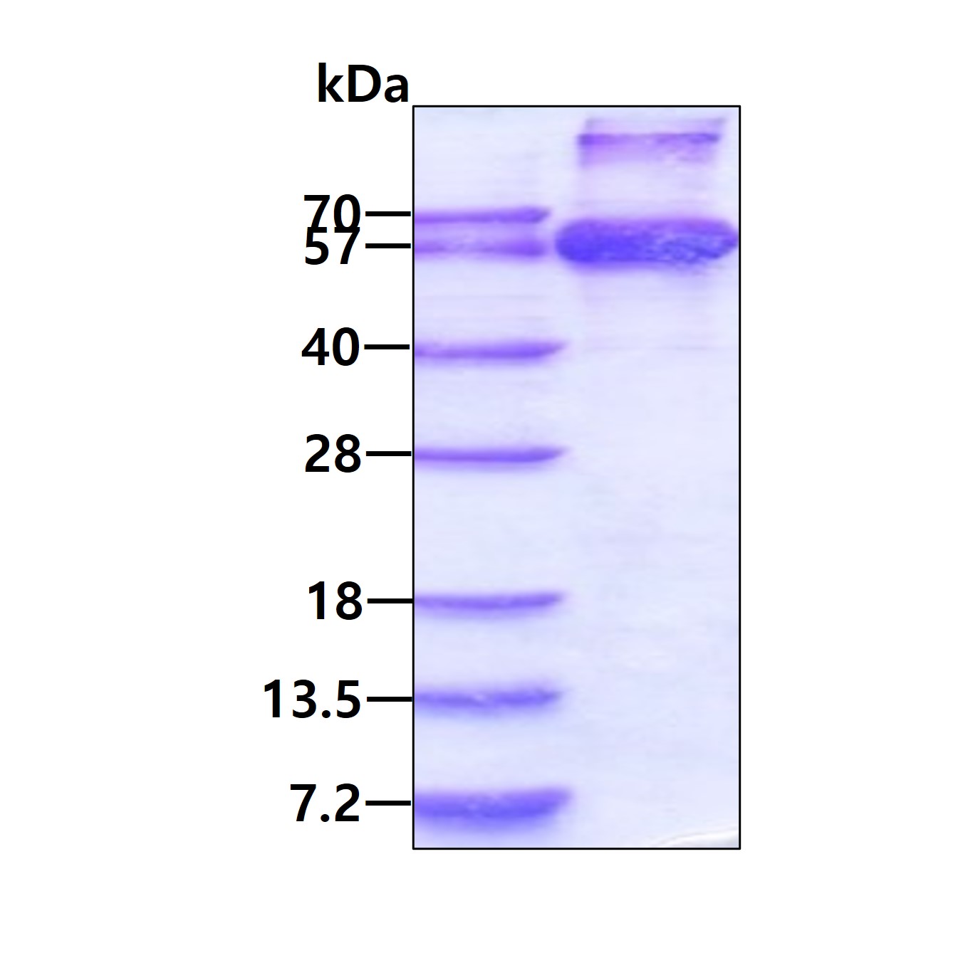SDS-PAGE - Recombinant Human HCM protein (AB108376)