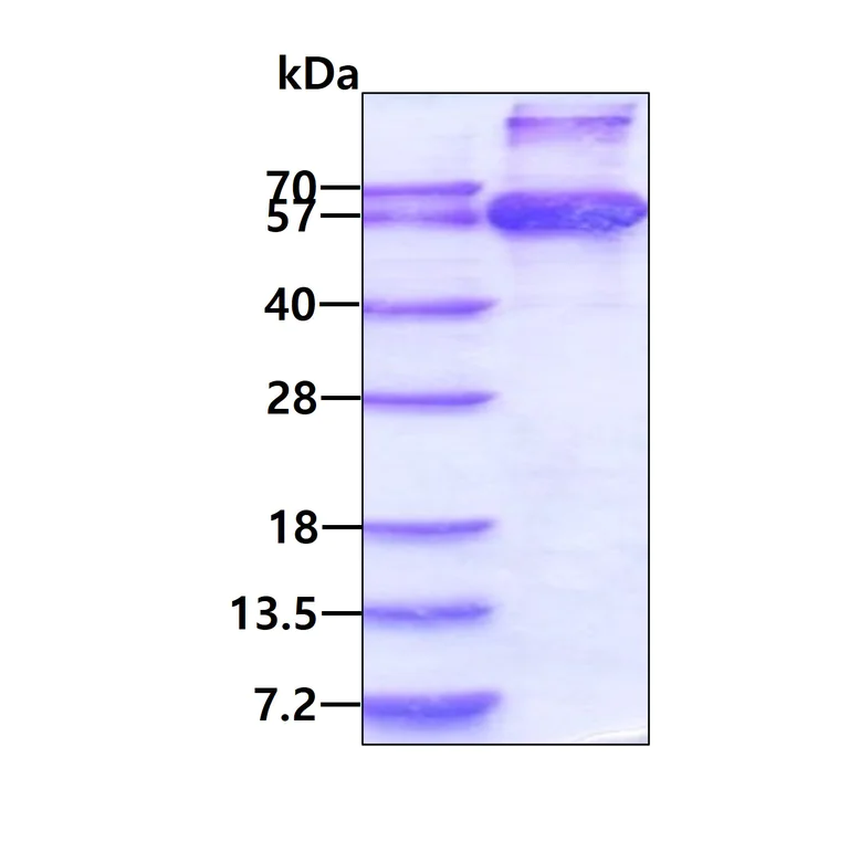 SDS-PAGE - Recombinant Human HCM protein (AB108376)