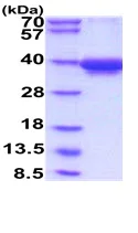 SDS-PAGE - Recombinant Human HCST protein (Fc tag C-Terminus + His tag C-Terminus) (AB229357)