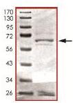 Recombinant Human HDAC11/HD11 protein