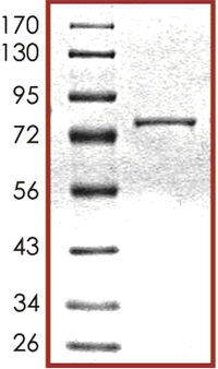 SDS-PAGE - Recombinant human HDAC4 protein (AB104029), expandable thumbnail