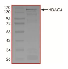 SDS-PAGE - Recombinant human HDAC4 protein (Active) (AB268614)