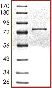 SDS-PAGE - Recombinant human HDAC4 protein (GST tag N-Terminus) (AB104029)