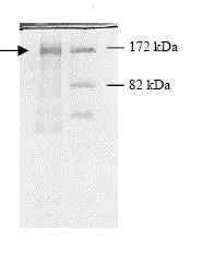 SDS-PAGE - Recombinant human HDAC5 protein (AB80348)