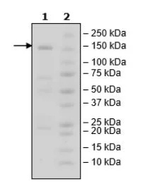 SDS-PAGE - Recombinant human HDAC5 protein (GST N-Terminus + His tag C-Terminus) (AB271803)