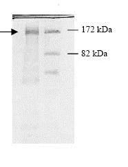 SDS-PAGE - Recombinant human HDAC5 protein (GST tag N-Terminus) (AB80348)