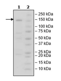 SDS-PAGE - Recombinant human HDAC5 protein (Tagged) (AB271803)