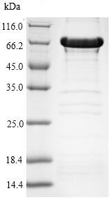 SDS-PAGE - Recombinant Human HDAC6 protein (Tagged) (AB226403), expandable thumbnail