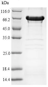 SDS-PAGE - Recombinant Human HDAC6 protein (Tagged) (AB226403)