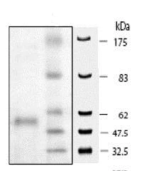 SDS-PAGE - Recombinant human HDAC9 protein (AB80350)