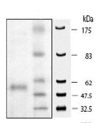 SDS-PAGE - Recombinant human HDAC9 protein (His tag C-Terminus) (AB80350)