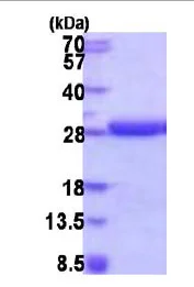 SDS-PAGE - Recombinant Human HDDC2 protein (His tag N-Terminus) (AB187615)
